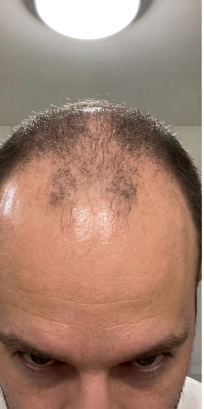 Mason, T before