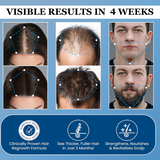 Aparthy™ Advanced Hair Growth System