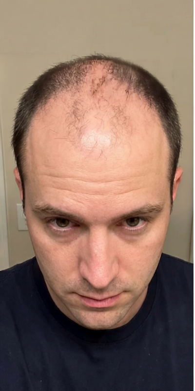 Mike C. before