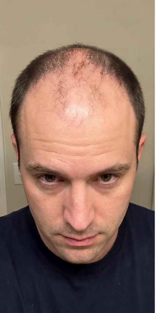 Mike C. before