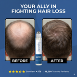 Aparthy™ Advanced Hair Growth System